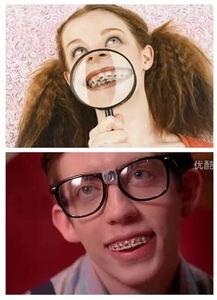 矫正器明星,引领时尚潮流的口腔护理新风尚